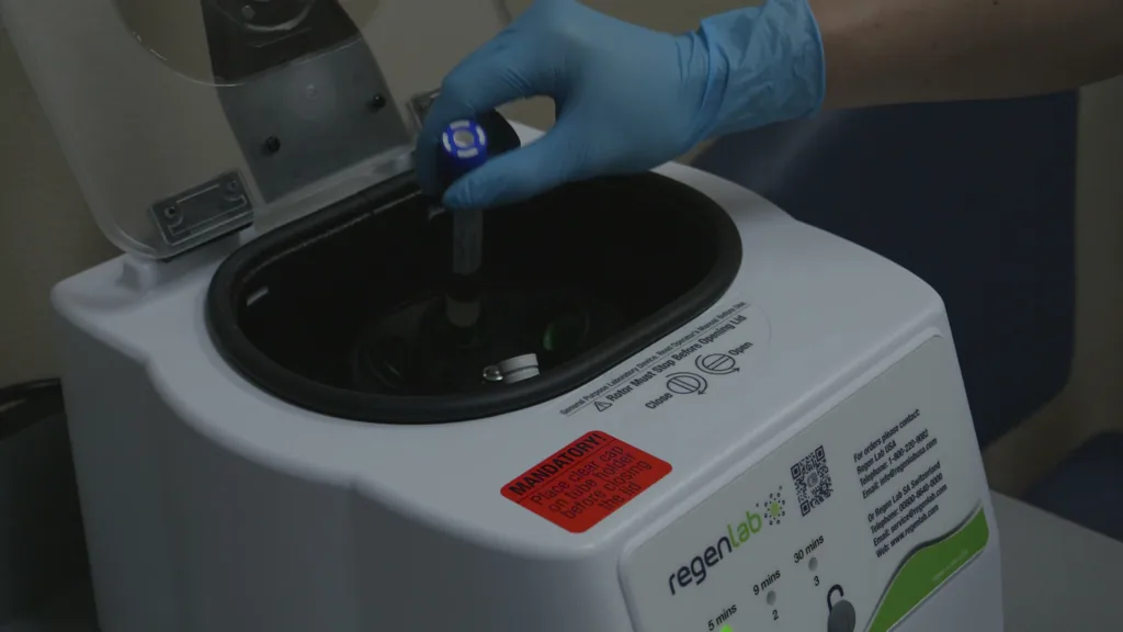 A gloved hand loads a tube into the centrifuge used to prepare PRP
